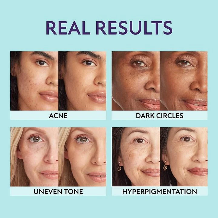 All-in-one moisturizer, concealer & coverage -- Lightweight & waterproof - Image 6