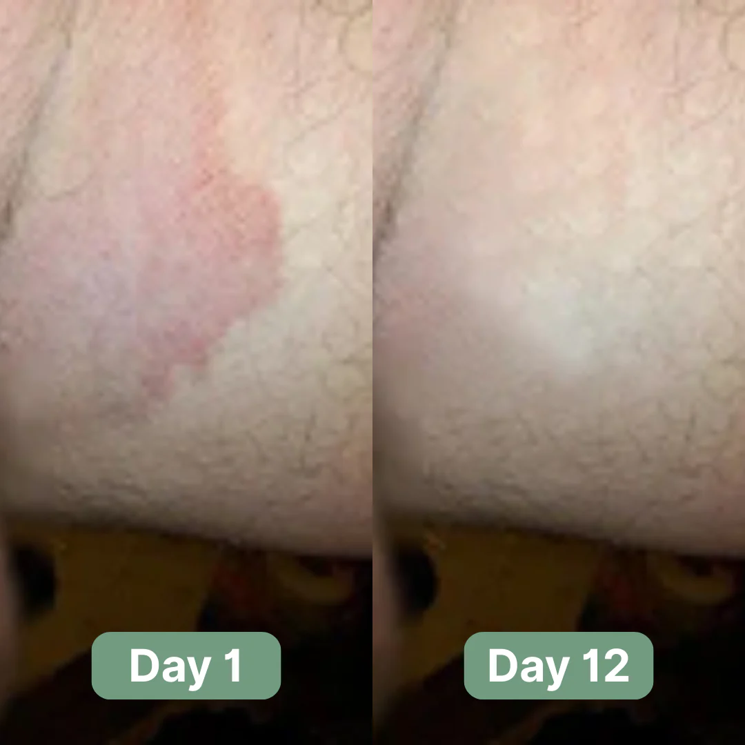 Andrew's Antifungal Soap - Image 4