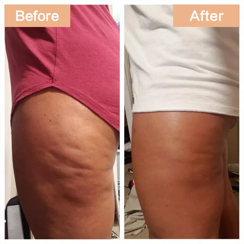 Anti-Cellulite Elixir - Image 4