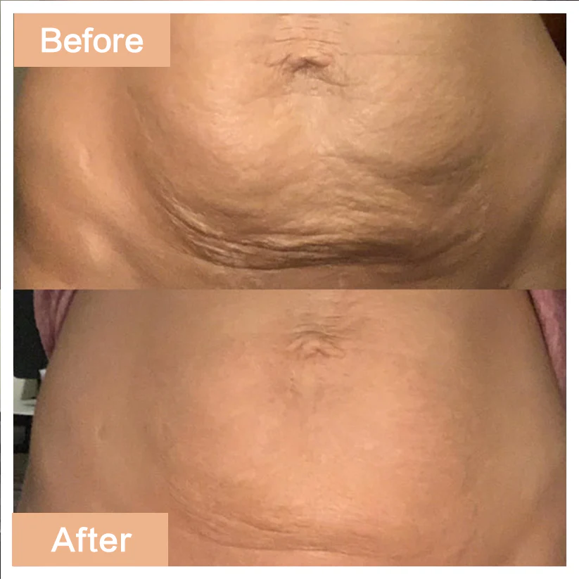 Anti-Cellulite Elixir - Image 5