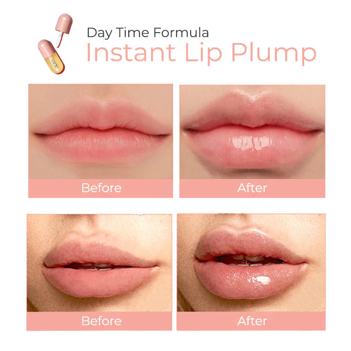 Lip Plumper Kit - Image 8