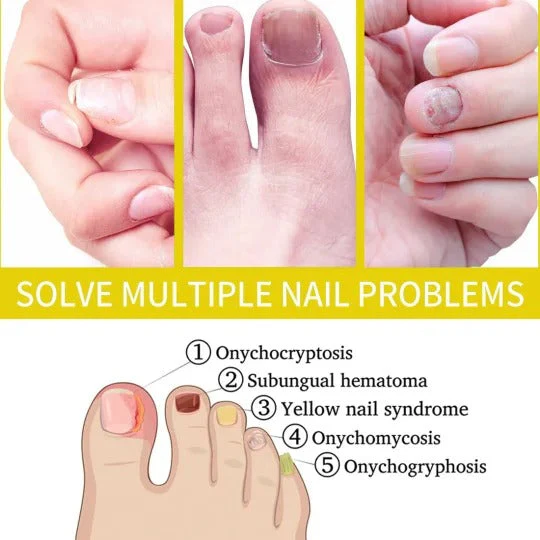 Nail Growth AndStrengthening Serum - Image 6