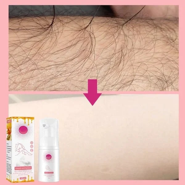 Smooth as Honey: Mousse Hair Removal Spray - Image 12