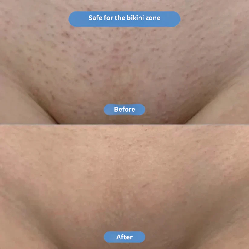 Lazzda Smoothing Serum - Image 5