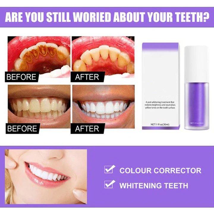 Teeth Colour Corrector Serum - Image 5