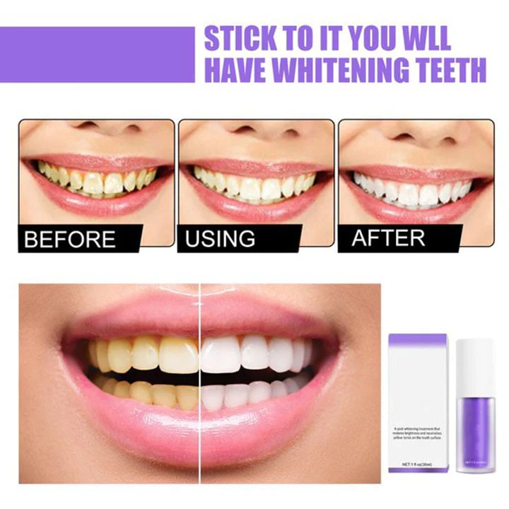 Teeth Colour Corrector Serum - Image 8