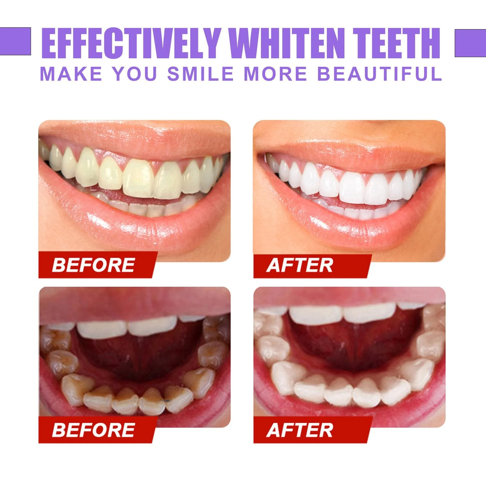 Teeth Colour Corrector Serum - Image 9