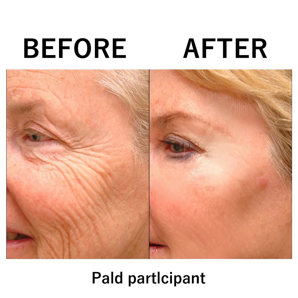 Temporary Face Tightener - Image 5