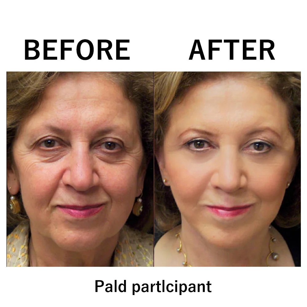 Temporary Face Tightener - Image 7