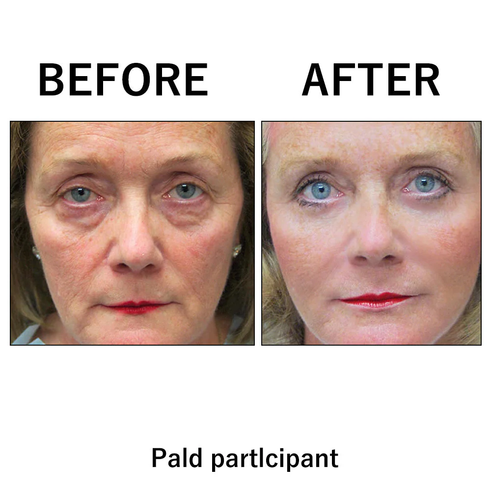 Temporary Face Tightener - Image 8